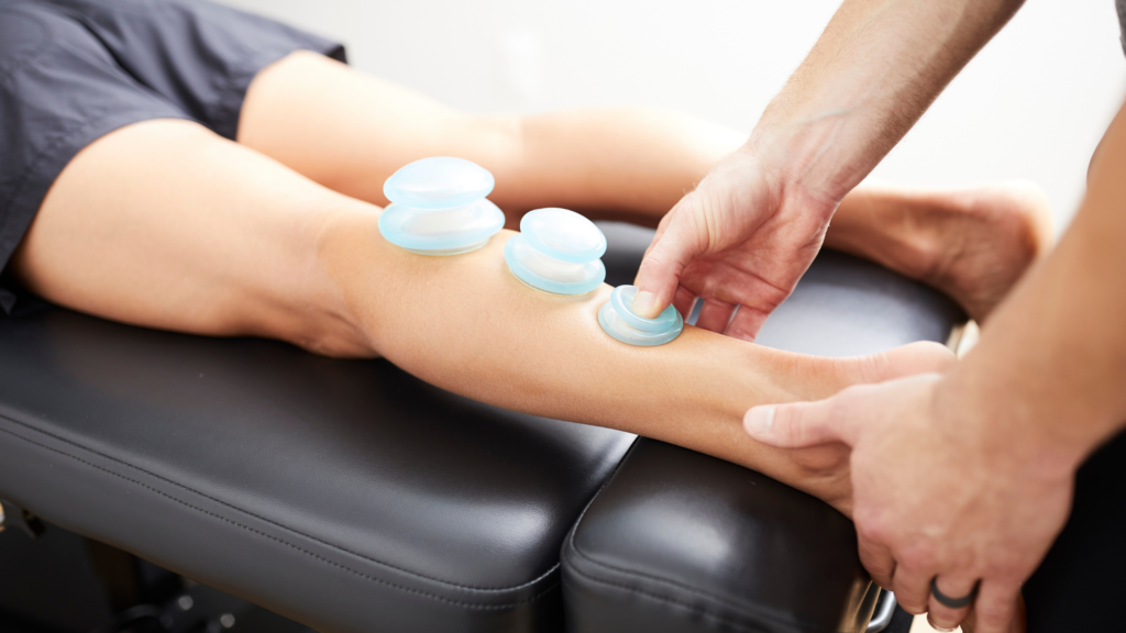 cupping therapy for achilles tendinitis